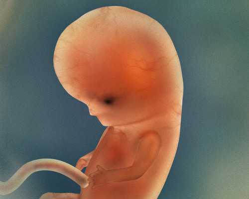 代孕那里最好,卵巢上有一个囊肿，并且月经不规律可以选择做试管婴儿吗？