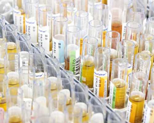 武汉中南医院做试管婴儿大概费用需要多少？