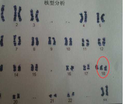 武汉哪家医院三代试管婴儿靠谱，实际花销不高！